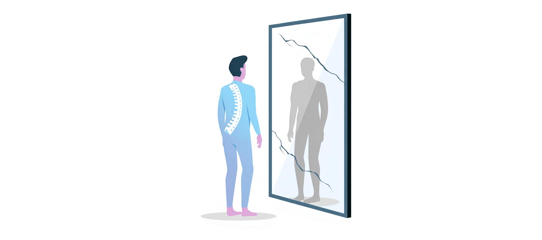 Skoliose und die Auswirkungen auf die Psyche